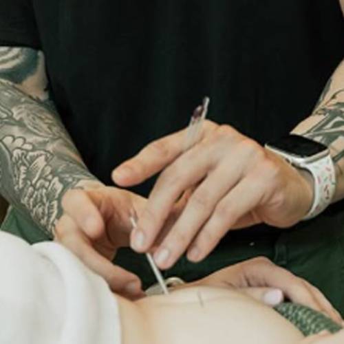 Feel Good Acupuncture & Wellness